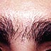 eyebrow shaping electrolysis before