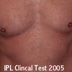 Clinical Test 2005