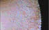 woman line before laser
