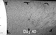 transdermal electrolysis clinical study day 40