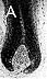 Follicle before transdermal electrolysis