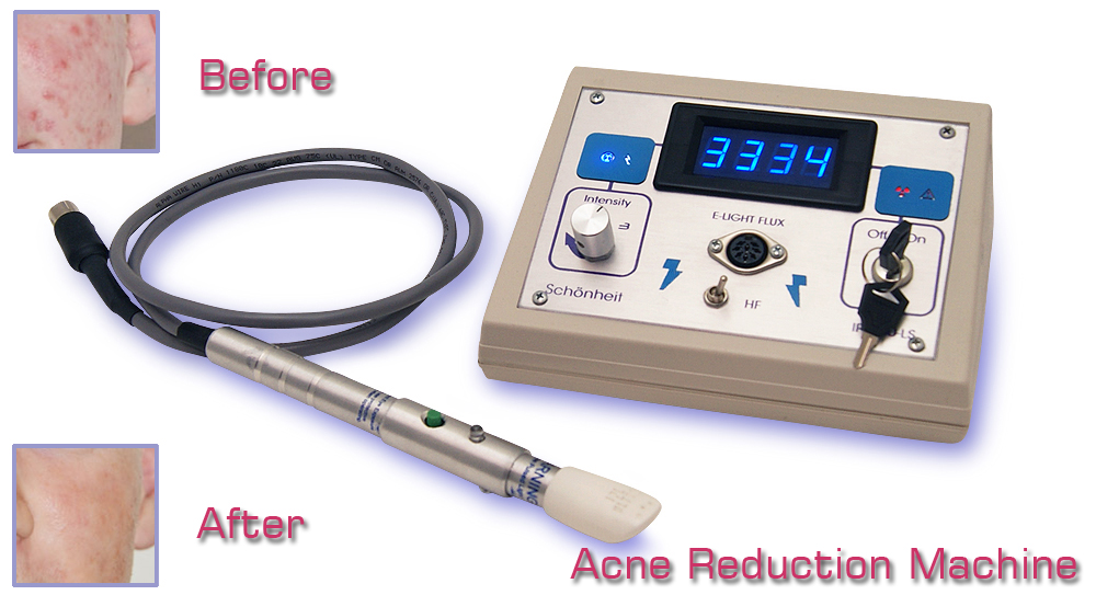 IPL350-LS Acne Treatment System