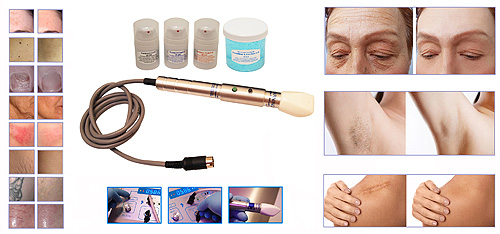 Approved For:  Permanent Hair Reduction, Spider - Varicose Vein Reduction, Skin Toning, Body Sculpting, Photo Rejuvenation, Hyper Pigment - Age Spot Reduction, Tattoo Reduction, Wrinkle Reduction, Scar - Stretch Mark Reduction, Rosacea, Sun Damage, Blemish (mole, wart, skin tag) Reduction, Nail Fungus Treatment and More. 