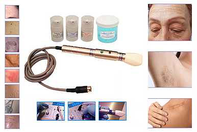 Approved For:  Permanent Hair Reduction, Spider - Varicose Vein Reduction, Skin Toning, Body Sculpting, Photo Rejuvenation, Hyper Pigment - Age Spot Reduction, Tattoo Reduction, Wrinkle Reduction, Scar - Stretch Mark Reduction, Rosacea, Sun Damage, Blemish (mole, wart, skin tag) Reduction, Nail Fungus Treatment and More. 