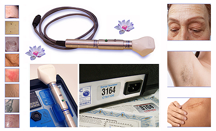 IPL950 is approved For:  Permanent Hair Reduction, Spider - Varicose Vein Reduction, Skin Toning, Body Sculpting, Photo Rejuvenation, Hyper Pigment - Age Spot Reduction, Tattoo Reduction, Wrinkle Reduction, Scar - Stretch Mark Reduction, Rosacea, Sun Damage, Blemish (mole, wart, skin tag) Reduction, Nail Fungus Treatment
